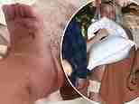 Britney Spears cries as she updates fans on her swollen ankle… as its revealed she injured herself by doing cartwheels: ‘My feet are so ugly’